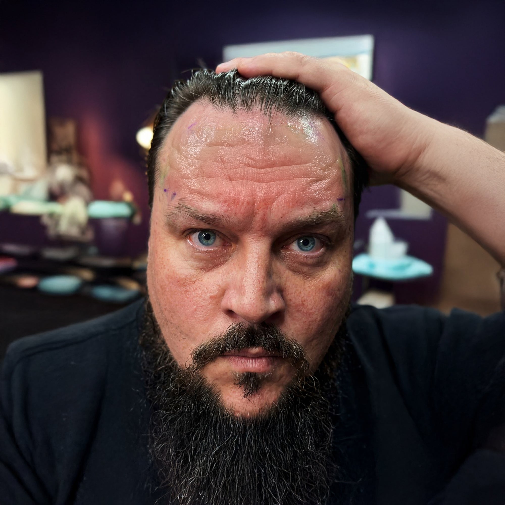 Charlie Sloth showing his forehead with tattoo removed